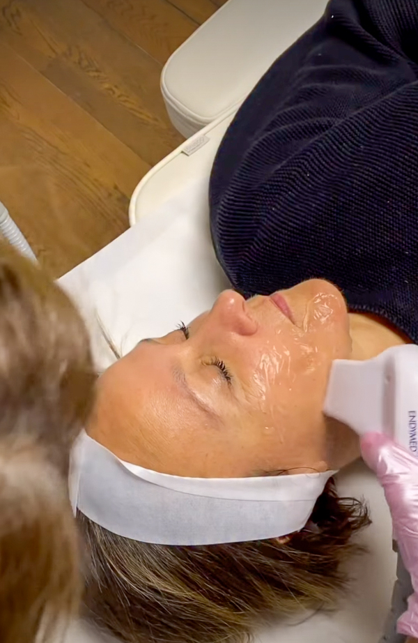 Radiofrequência facial, IG @sadaf_jaffari | Treatwell