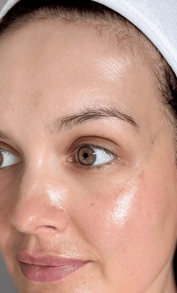 Peeling de vitamina C, IG @skincarebyjoanne | Treatwell