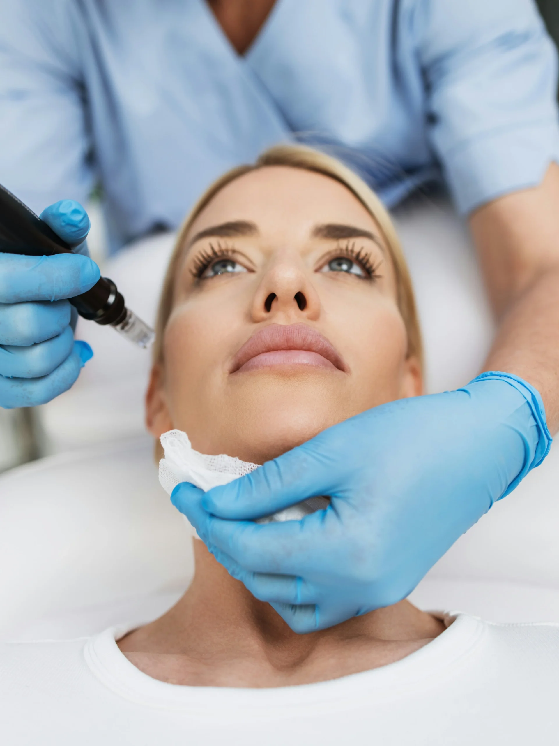 Plano aproximado do rosto de uma mulher enquanto relaxa numa marquesa e recebe um tratamento de microneedling numa clínica