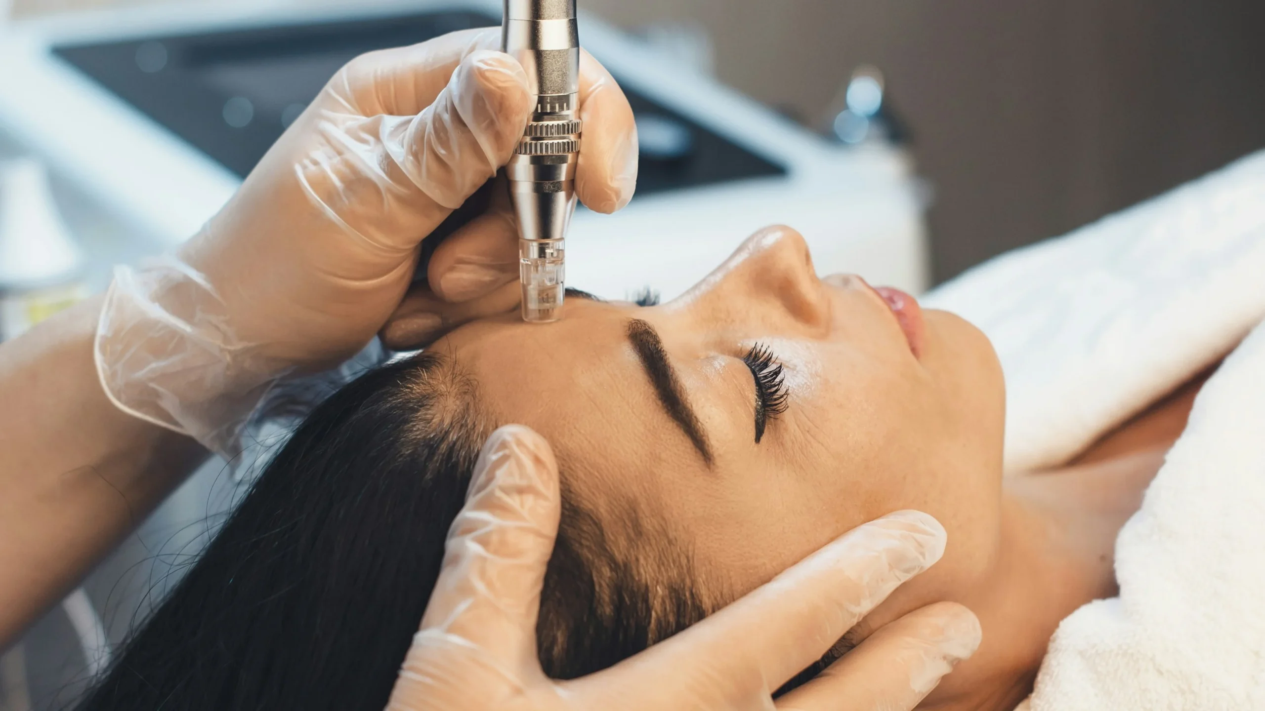 Plano aproximado de um tratamento profissional de microneedling no rosto de uma mulher numa clínica