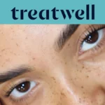 Banner turquesa da Treatwell com um grande plano de pestanas naturalmente levantadas após um lifting de pestanas coreano, sobre pele com sardas