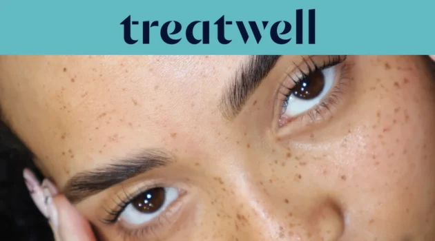 Banner turquesa da Treatwell com um grande plano de pestanas naturalmente levantadas após um lifting de pestanas coreano, sobre pele com sardas