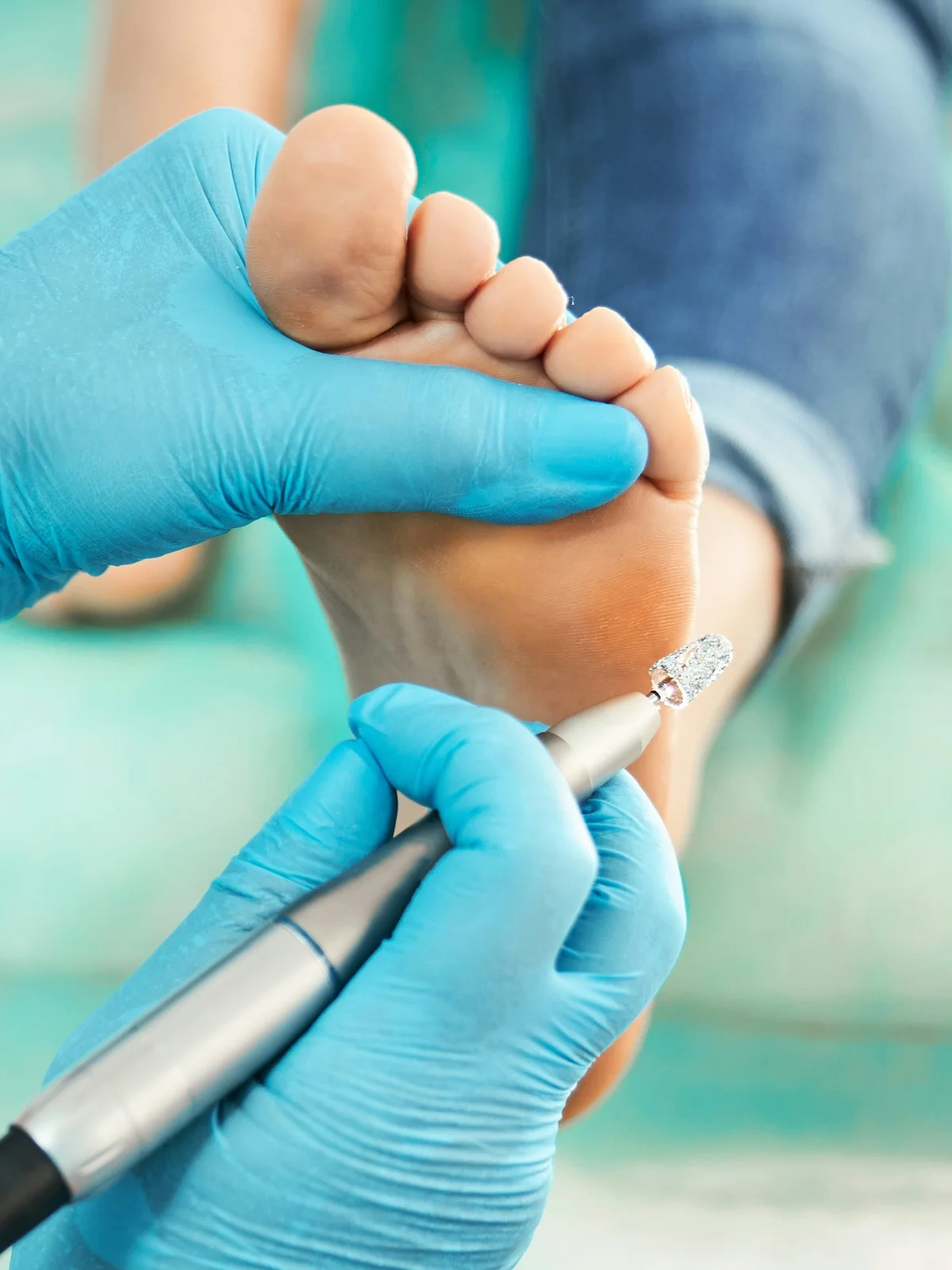 Grande plano de uma esteticista com luva a esfoliar suavemente a pele do pé de uma cliente com uma pequena broca elétrica