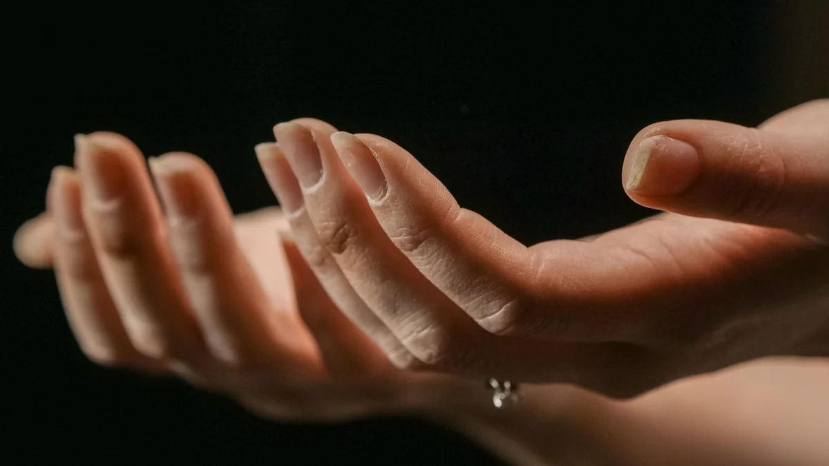 Duas mãos estendidas com as palmas voltadas para cima e unhas a descamar