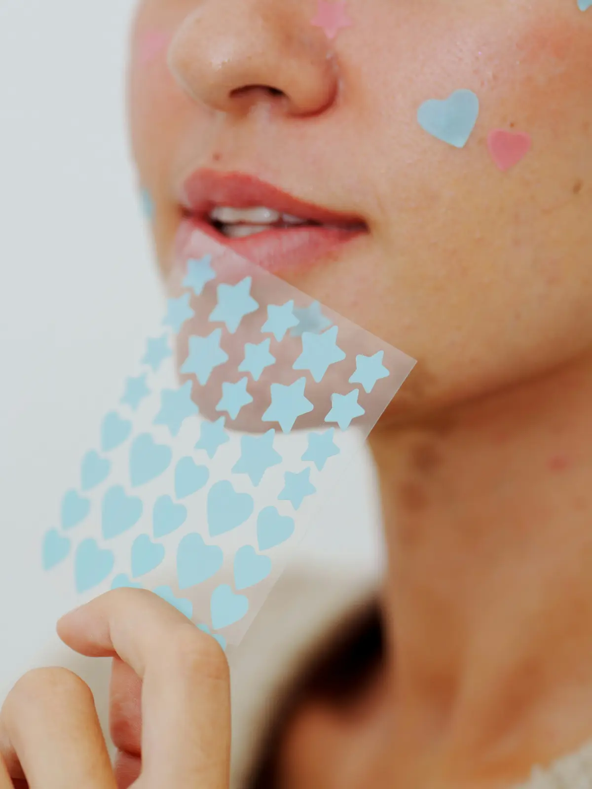 Grande plano do rosto de uma mulher com alguns pensos hidrocoloides em forma de coração e de estrela sobre as borbulhas