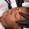 Grande plano de uma esteticista a realizar dermaplaning numa cliente num centro de estética