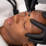 Grande plano de uma esteticista a realizar dermaplaning numa cliente num centro de estética